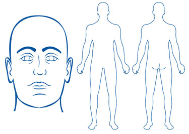 Body Diagram